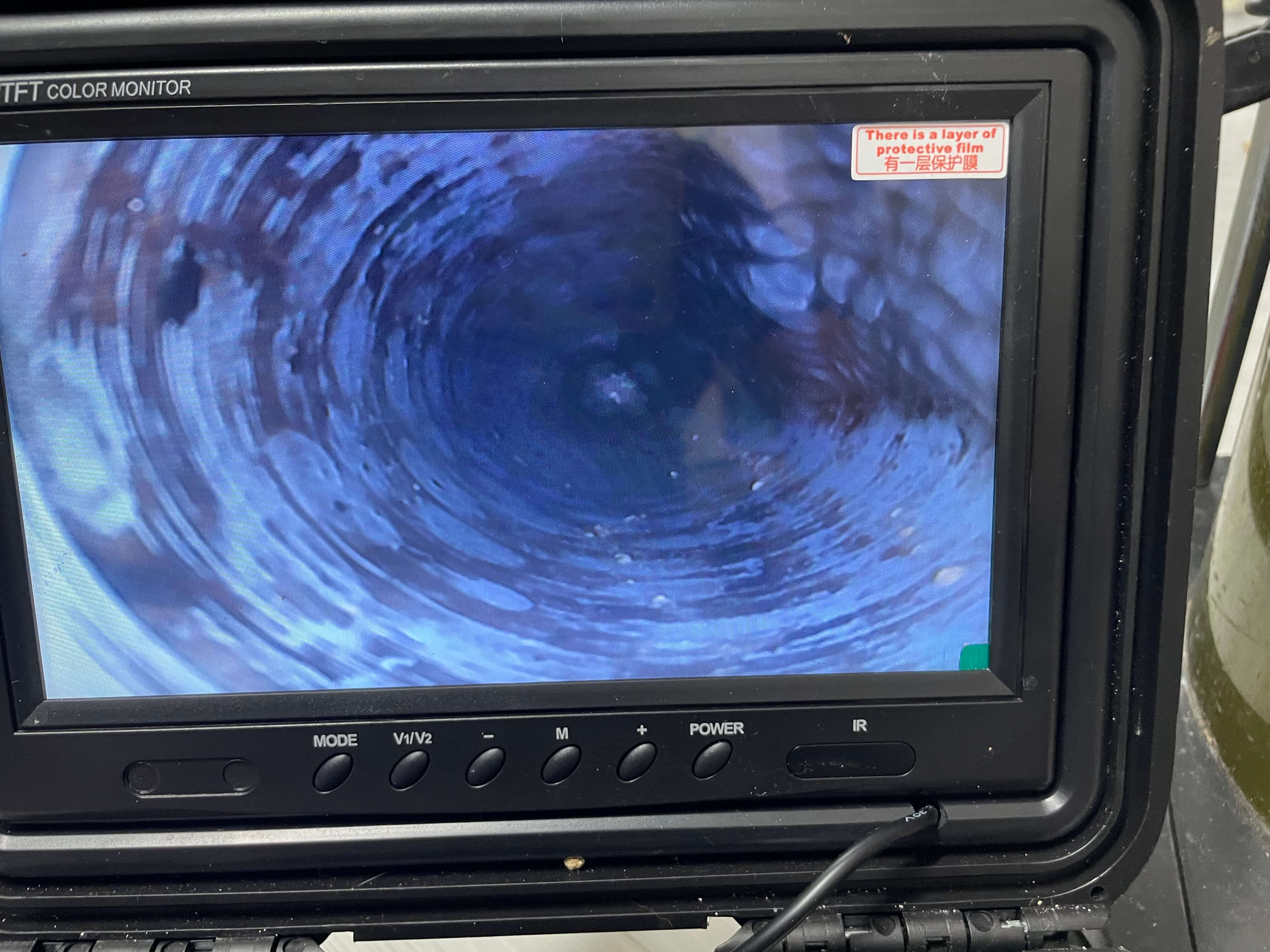 내시경 작업 진행 모습 - 막힘 원인 정확한 진단